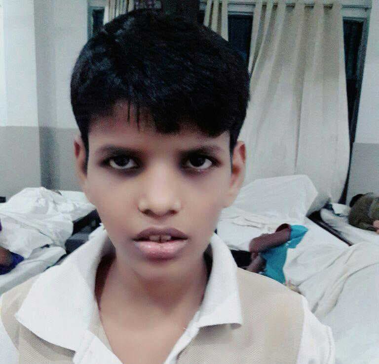 India’s ‘Mowgli Girl’ dies at 18 after years of care and rehabilitation