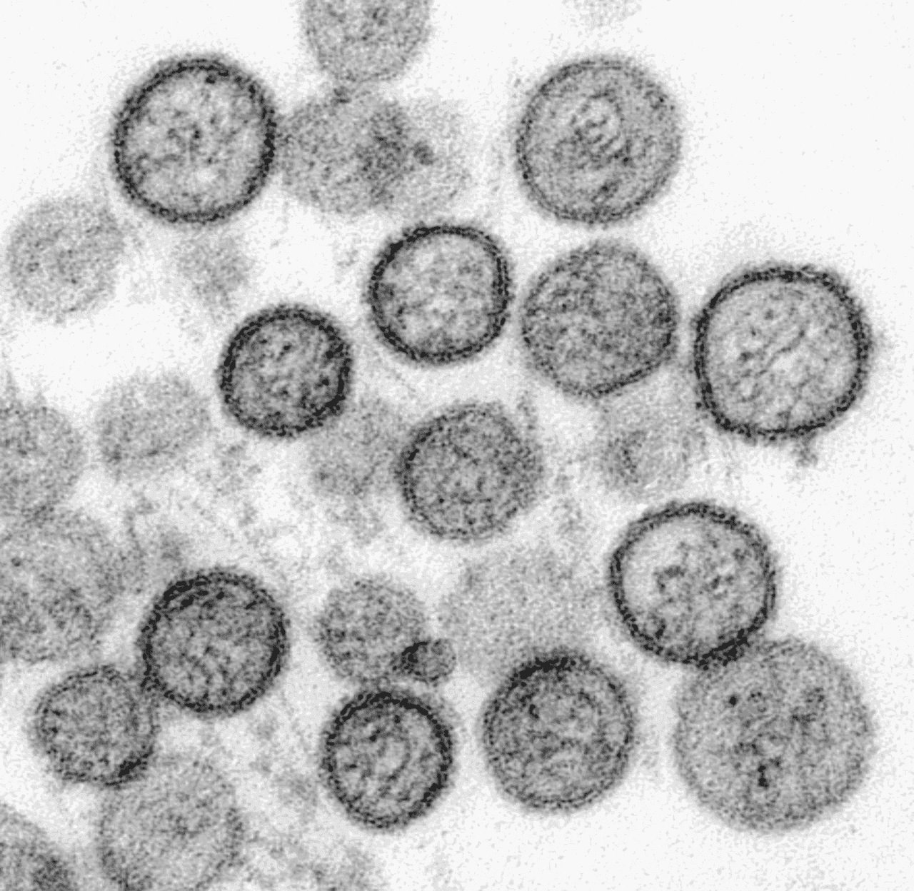 What is Hantavirus? How does it spread? How to prevent it? Virus linked to three cruise deaths