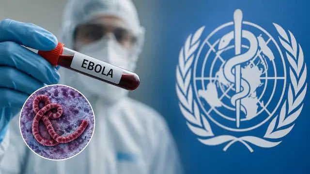 Second suspected Ebola patient admitted in Hyderabad as authorities await test results